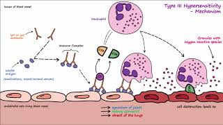 Type III Hypersensitivity [upl. by Eeleak]