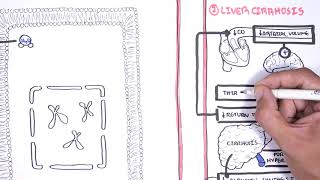 Hyponatraemia Hyponatremia  classification causes pathophysiology treatment [upl. by Asaeret]