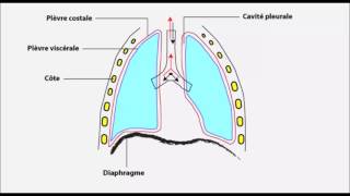 Pleurésie inflammation de la plèvre [upl. by Mckenna390]