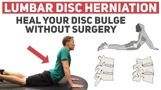 How to Heal Your Disc Herniation Without Surgery [upl. by Isabella]