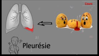 Pleurésie 🤒🤔 Tous ce que vous devez connaître  Cours  PneumoPhtisiologie [upl. by Elyssa822]