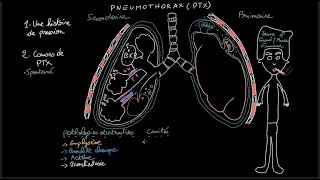 Pneumothorax  Docteur Synapse [upl. by Eben]