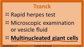 Herpes Mono HSV Chickenpox Shingles EBV CMV Cold Sore VZV Varicella [upl. by Lielos]