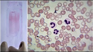 Blood Smear Preparation and Staining Practical Lab [upl. by Beisel]