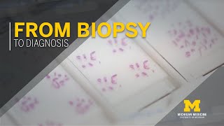 Biopsy Procedure Overview Dermatology [upl. by Gussi219]