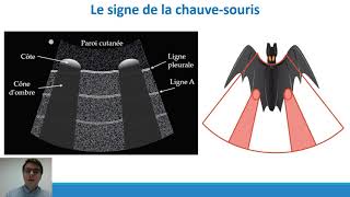 Elearning n°1  Echographie pleuropulmonaire dans la dyspnée aiguë  Thèse François M [upl. by Lunn]