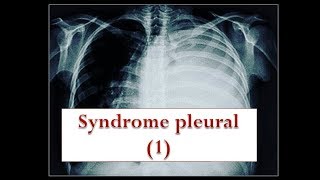 le syndrome pleural partie 1 [upl. by Nosnej]