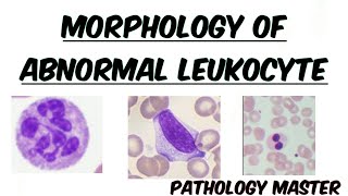 Abnormal Leukocyte Morphology  In Peripheral Blood Smear  Images  Made Easy [upl. by Varick]