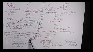 MEJOR EXPLICACIÓN COLELITIASIS COLECISTITIS COLEDOCOLITIASIS COLANGITIS [upl. by Mendes]