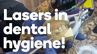 Four ways a dental hygienist can use lasers [upl. by Reamy]