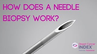 Quick Core Biopsy Needles Device Animation [upl. by Noirod]