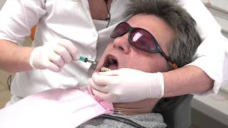 Painless Periodontitis treatment with the laser Laser treatment at gingivitis Part 1 [upl. by Akapol8]