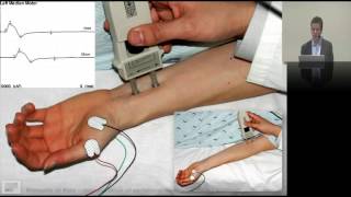 25 Interpreting neurophysiology EMG amp NCS [upl. by Weihs]