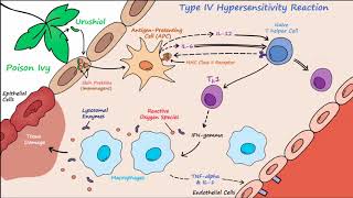 Type IV Hypersensitivity Described Concisely [upl. by Sinned8]