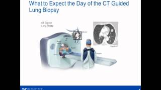 Skin Biopsy  CIMS Hospital [upl. by Carry217]