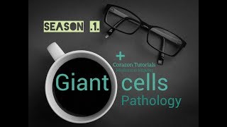 Giant Cells Pathology  All 10 types  Reed Sternberg Cells  Physiology [upl. by Bonnie235]