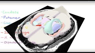 Basal Ganglia 3D Tour [upl. by Semele]