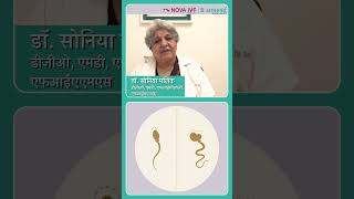 Semen Analysis  Dr Sonia Malik  Nova IVF Vasant Vihar  Delhi NCR [upl. by Cave]